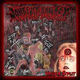 JonBenet Ramsey : Vagina Split